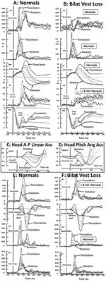 Commentary: An Initial Passive Phase That Limits the Time to Recover and Emphasizes the Role of Proprioceptive Information